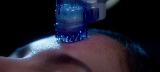 A blue lit micro needling device sits on a forehead above a closed eye in a dark room. Frame from the commercial Saelo, Skin treatments.